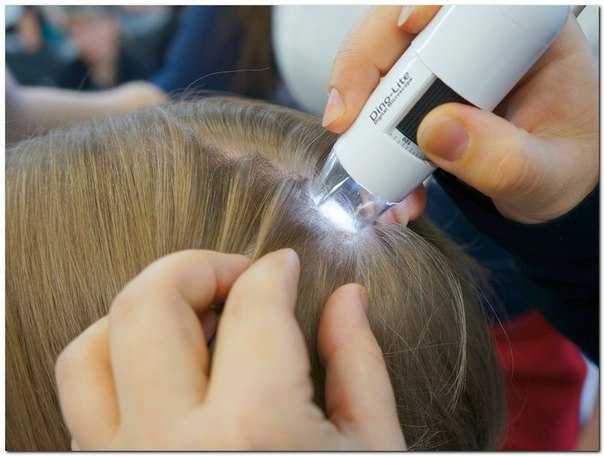 Восстановление волос после коронавируса