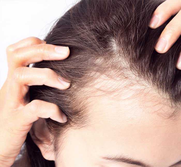 Норма выпадения волос в день при мытье и расчесывании  | capillum clinic