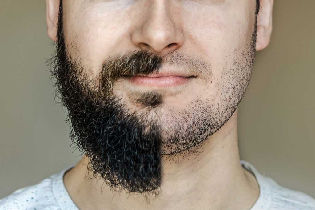 Главные виды бород у мужчин — от трехдневной щетины до эспаньолки