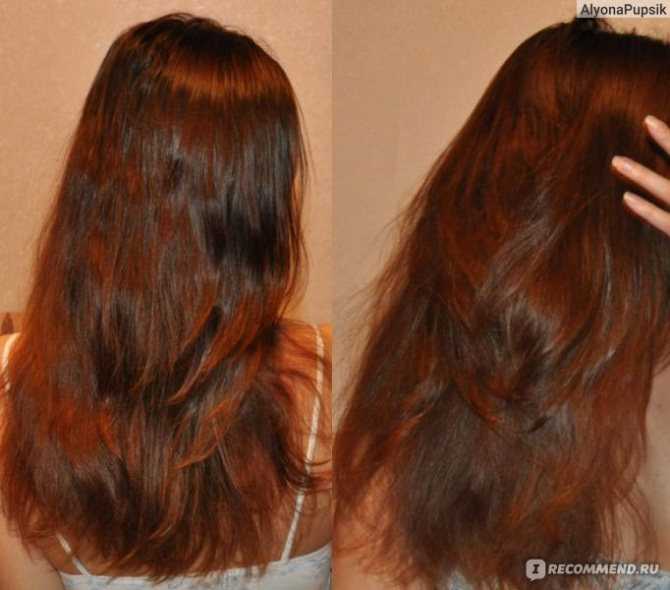 Что делать если сильно выпадают волосы луковой шелухой