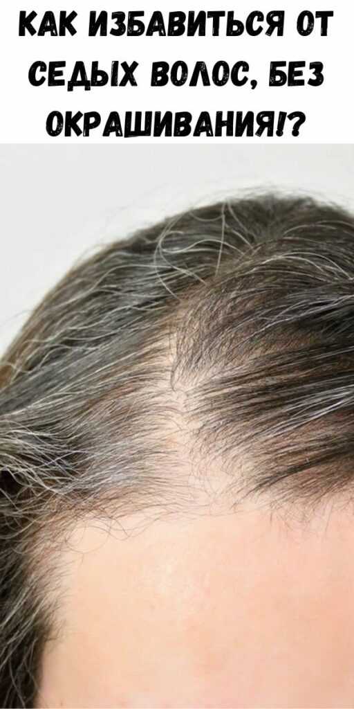 Лечение выпадения волос у женщин