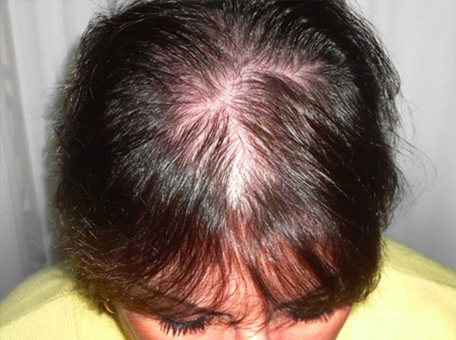 Виды повреждений волос. что делать при разрушении структуры волос