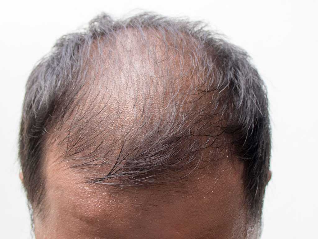 Ошибки окрашивания волос - 20 ошибок при самостоятельном окрашивании волос