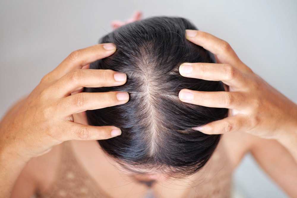 5 советов, как ухаживать за жирными волосами Рейтинг лучших средств от жирности волос и натуральные заменители шампуней, которые можно приготовить в домашних условиях