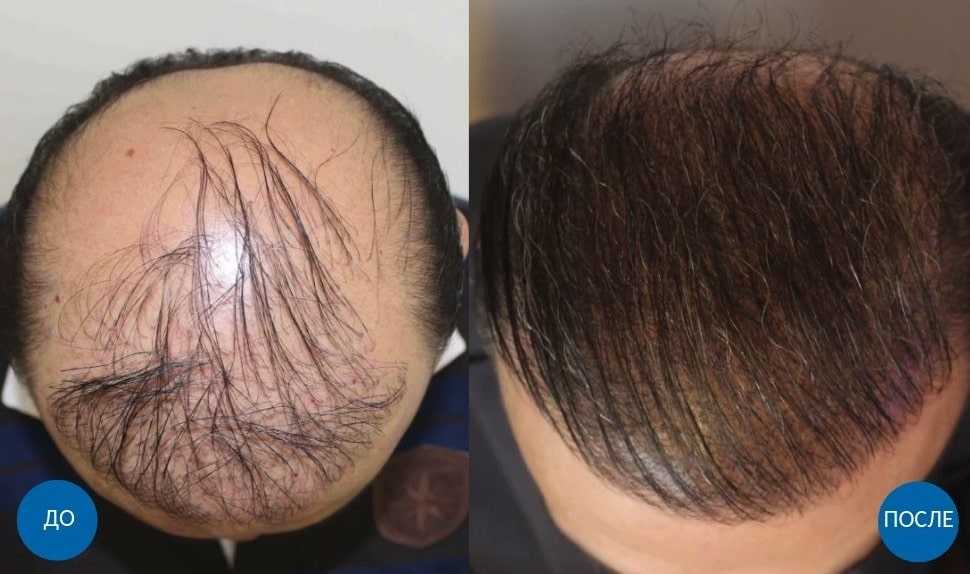 Наращивание волос по итальянской технологии от мастера: пошаговая инструкция