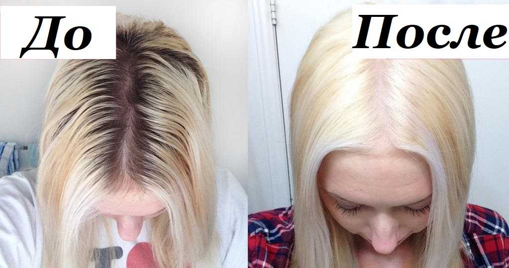 Могут ли потемнеть волосы от перекиси водорода