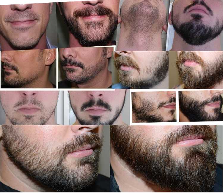 Все формы и виды бороды у мужчин