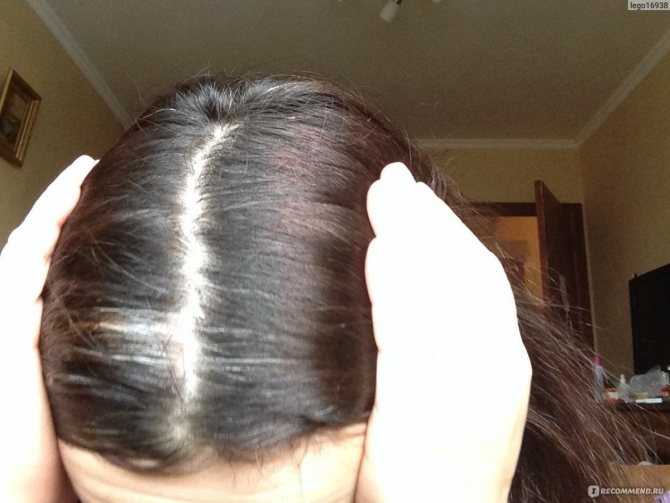 Скрыть седину и не навредить волосам: действенные методы
