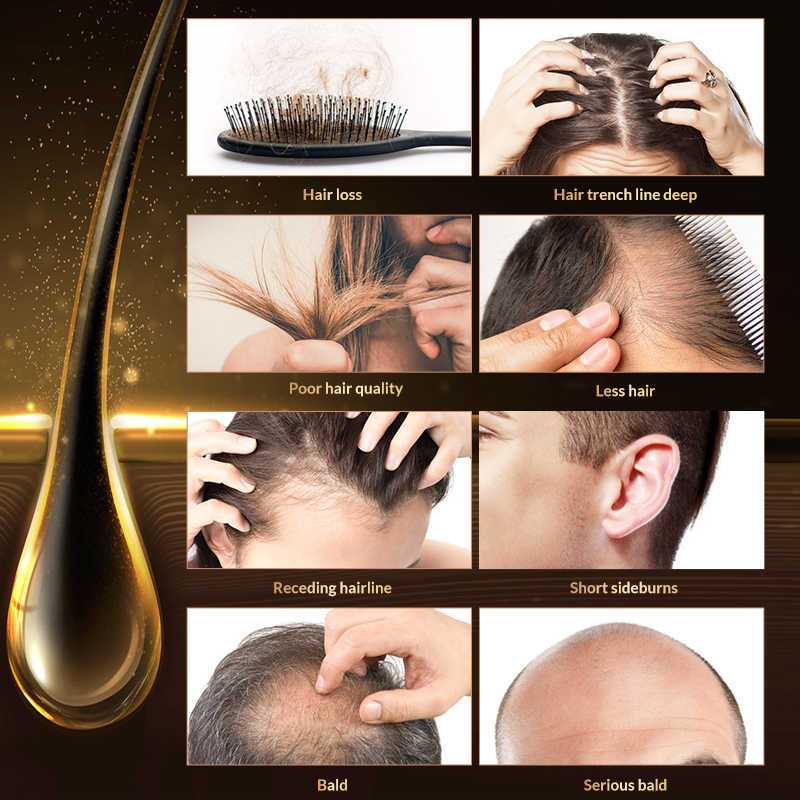 Кальций для волос: отзывы, влияние кальция на выпадение полос