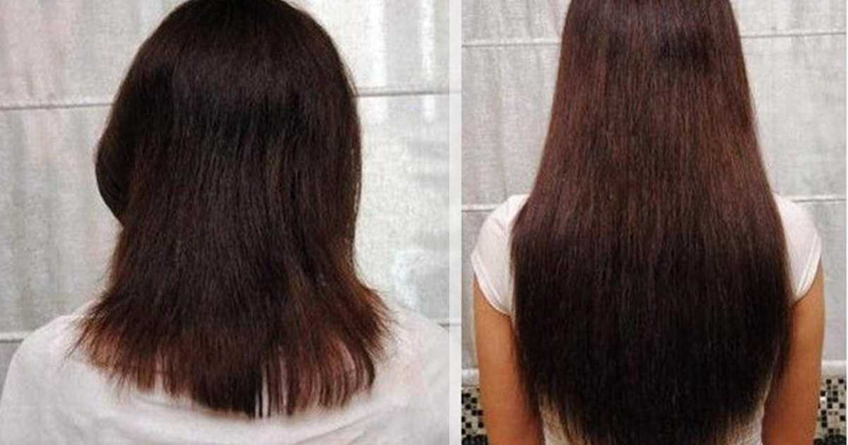 Как быстро ускорить рост волос на голове в домашних условиях