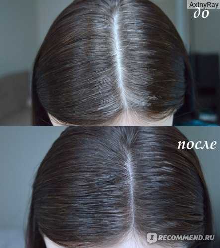 Народные средства от седины: лучшие рецепты для восстановления цвета волос