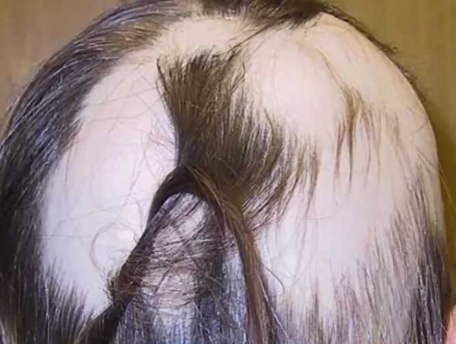 Масло жожоба – настоящее спасение для сухих и ломких волос, склонных к выпадению