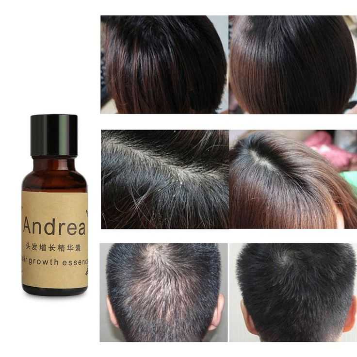 Сыворотка для роста волос andrea hair growth essence