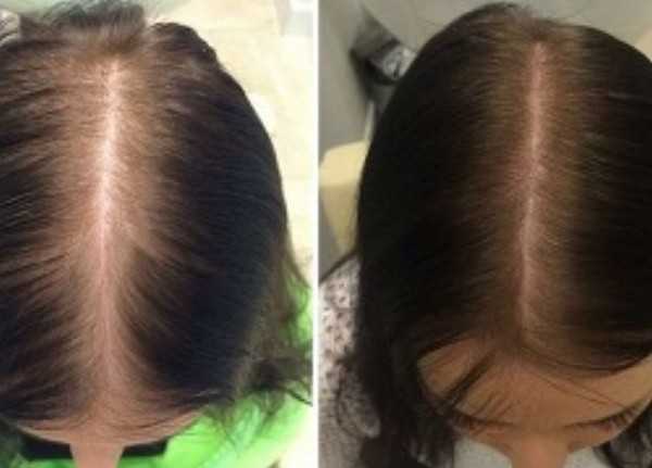 Сатура роста (satura rosta) для волос: состав и стоимость бальзама, пошаговая инструкция по применению