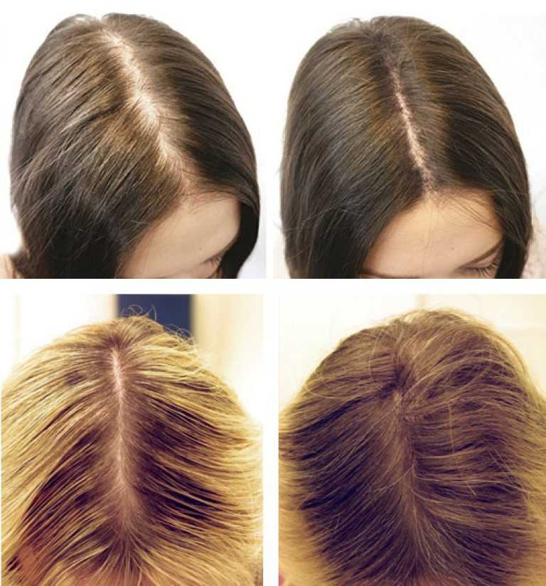 Как сделать пробор волос по середине