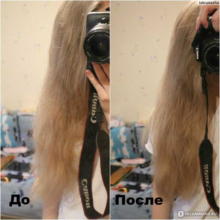 Что делать, если волосы истончаются или тонкие