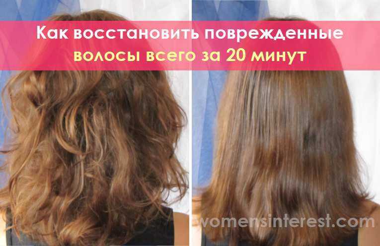 Андрогенное облысение у женщин, лечение андрогенетической женской алопеции