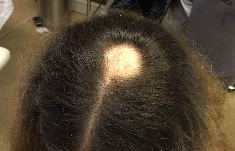 Как избежать выпадения волос?