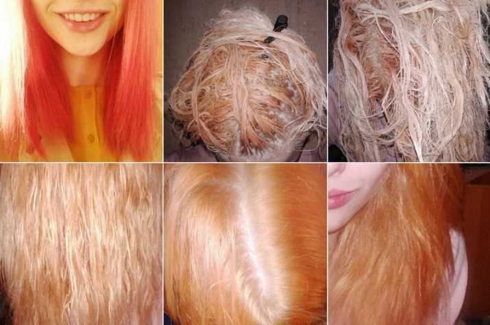 Осветление волос перекисью в домашних условиях: как сделать