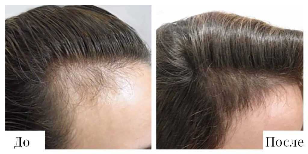 Как быстро растут волосы на голове - фазы и скорость роста, факторы влияния