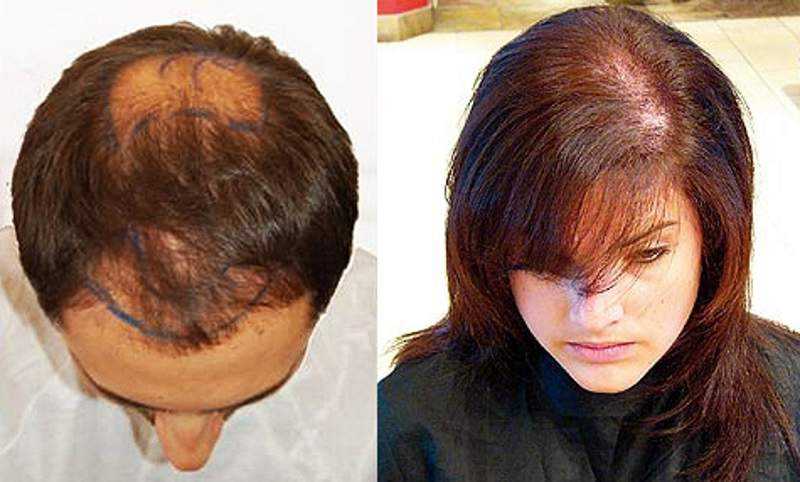 Влияние краски на волосы: с аммиаком, без аммиака, тоники, природные красители Причины от чего выпадают волосы после окрашивания Способы восстановления Способы предотвращения выпадения