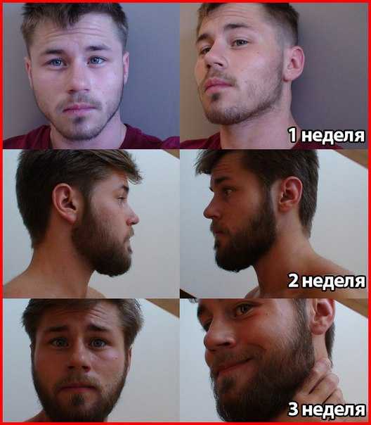 За сколько отрастают волосы у мужчин