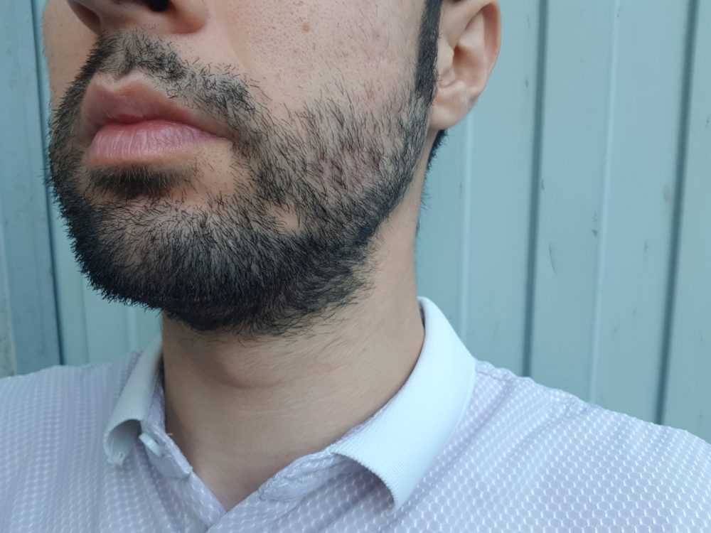 Почему борода бывает жесткой и как с этим бороться? - dorco.ru
