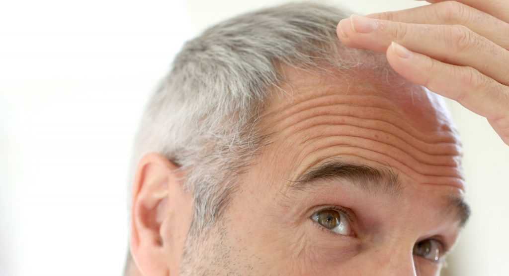 Преждевременное поседение волос. основные причины