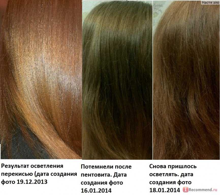 Лечение выпадения волос после осветления - клиника ренео.
